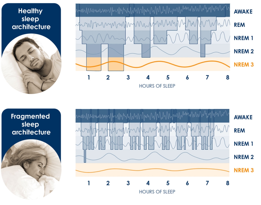 Sleep System Blocks About – AstronauTx